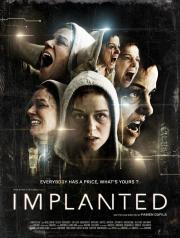 Implanted