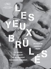 Les yeux brûlés